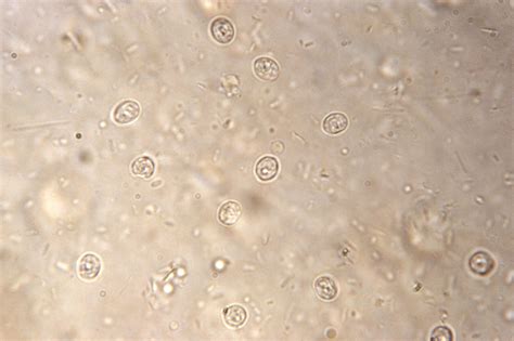 Cryptosporidium! This Microscopic Menace Lurks Everywhere, Even in Your Drinking Water!