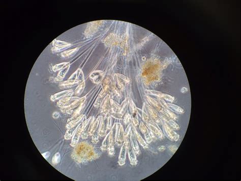 Film-Coated Filamentous Friend: Exploring the Enigmatic World of _Filamentina_ Ciliates!