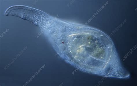  Gilbartia! Unveiling the Mysteries of This Tiny Ciliate Mastermind With Remarkable Predatory Tactics