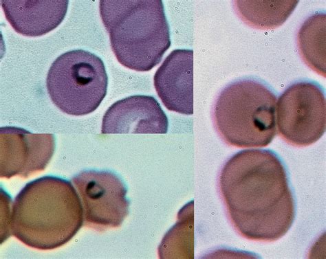 Plasmodium—A Tiny Terrorist With a Thirst for Red Blood Cells!