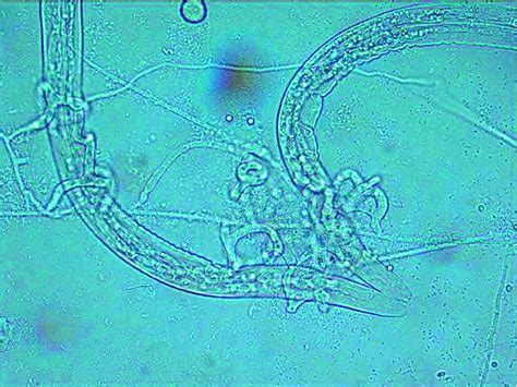 Zoogonus! A Single-Celled Parasite That Plays Hide-and-Seek with Its Hosts